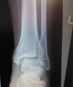 1 Xray 12 Feb 13.jpg