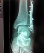 2 Xray 26 feb 13.jpg