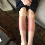 heard-were-doing-funny-sunburns-my-girlfriends-legs-after-hiking-her-first-er-in-colorado-304635.jpg