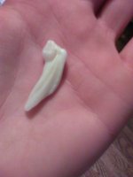 bens tooth1.jpg