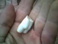 tooth2.JPG