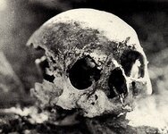 Ruth Skull Right Side.jpg