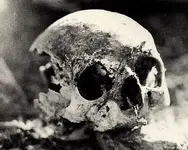 Ruth Skull Right Side.webp