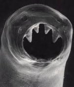 hookworm.jpg