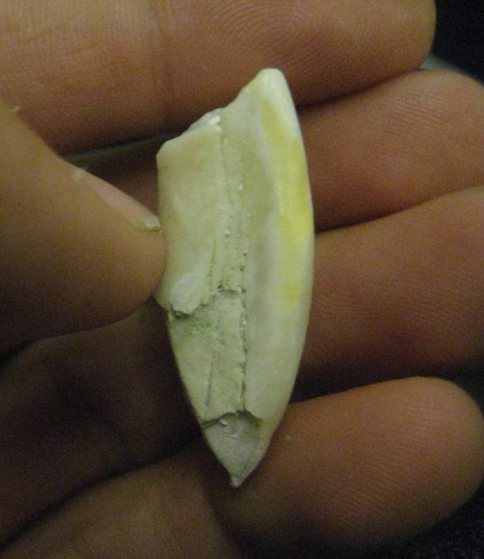 Tooth