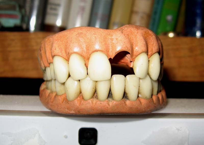 teeth2_zps78e3ffe2.jpg